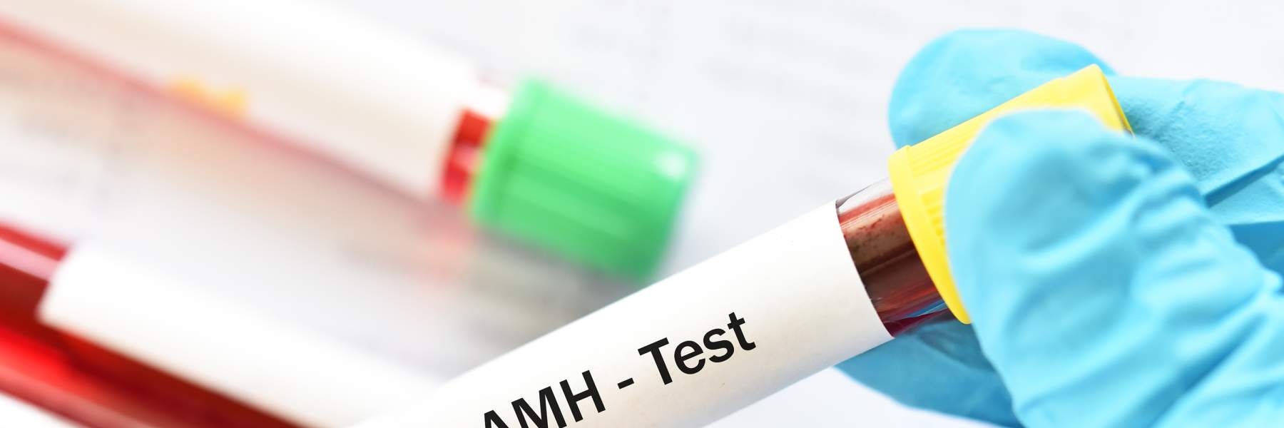 AMH Blood Test