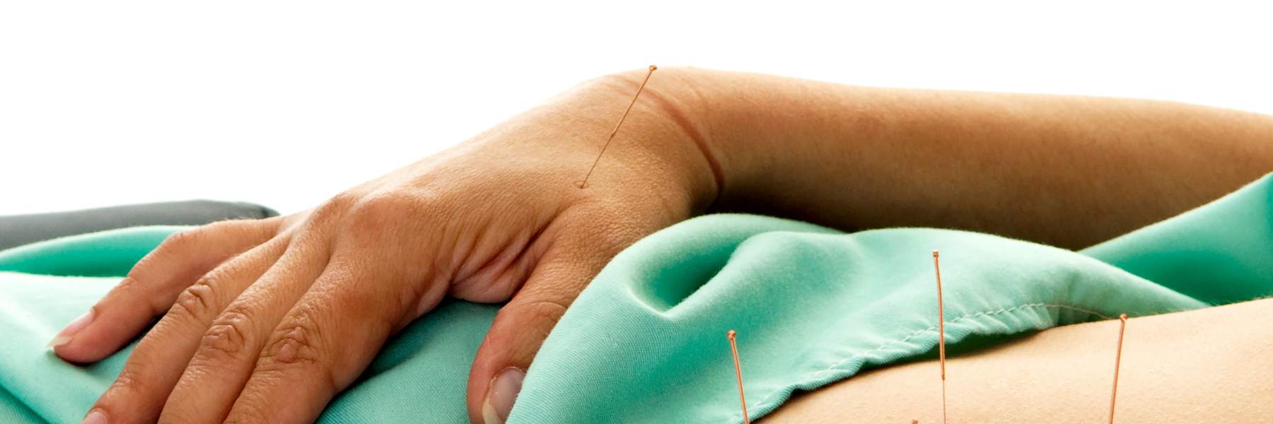 Acupuncture for endo pain relief