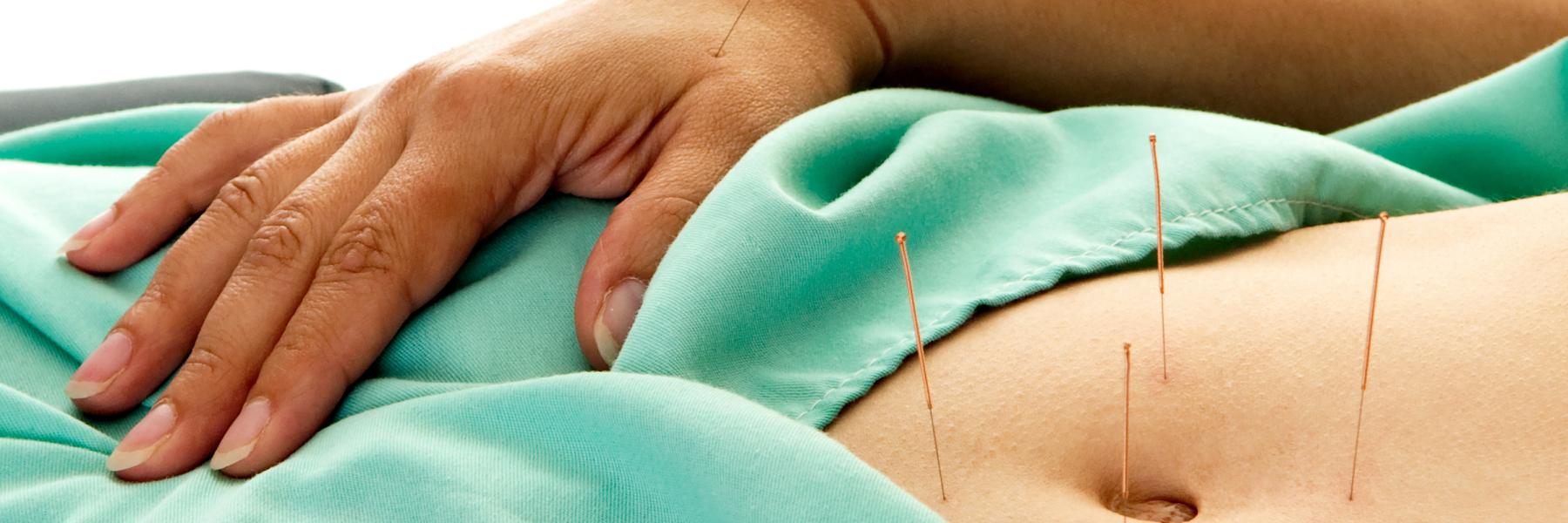 Acupuncture for endo pain relief
