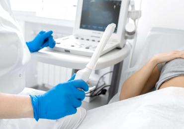 Picture of transvaginal ultrasound probe and machine