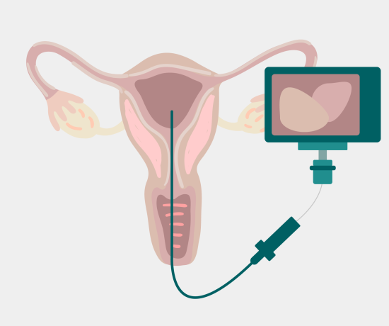 Hysteroscopy camera
