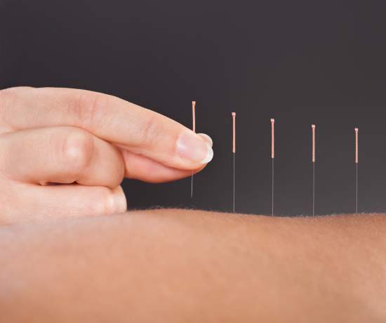 Acupuncture for endo pain relief